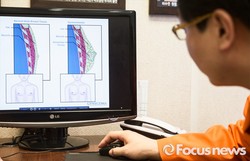 thumbimg